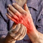 Kézekcéma ellen tudatosan: Így építsd újjá a bőröd védőpajzsát!